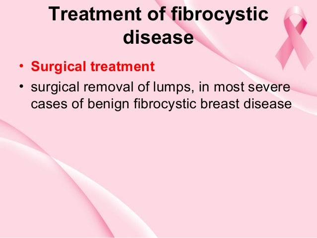 cure for fibrocystic breast Vennessa hudgens porn